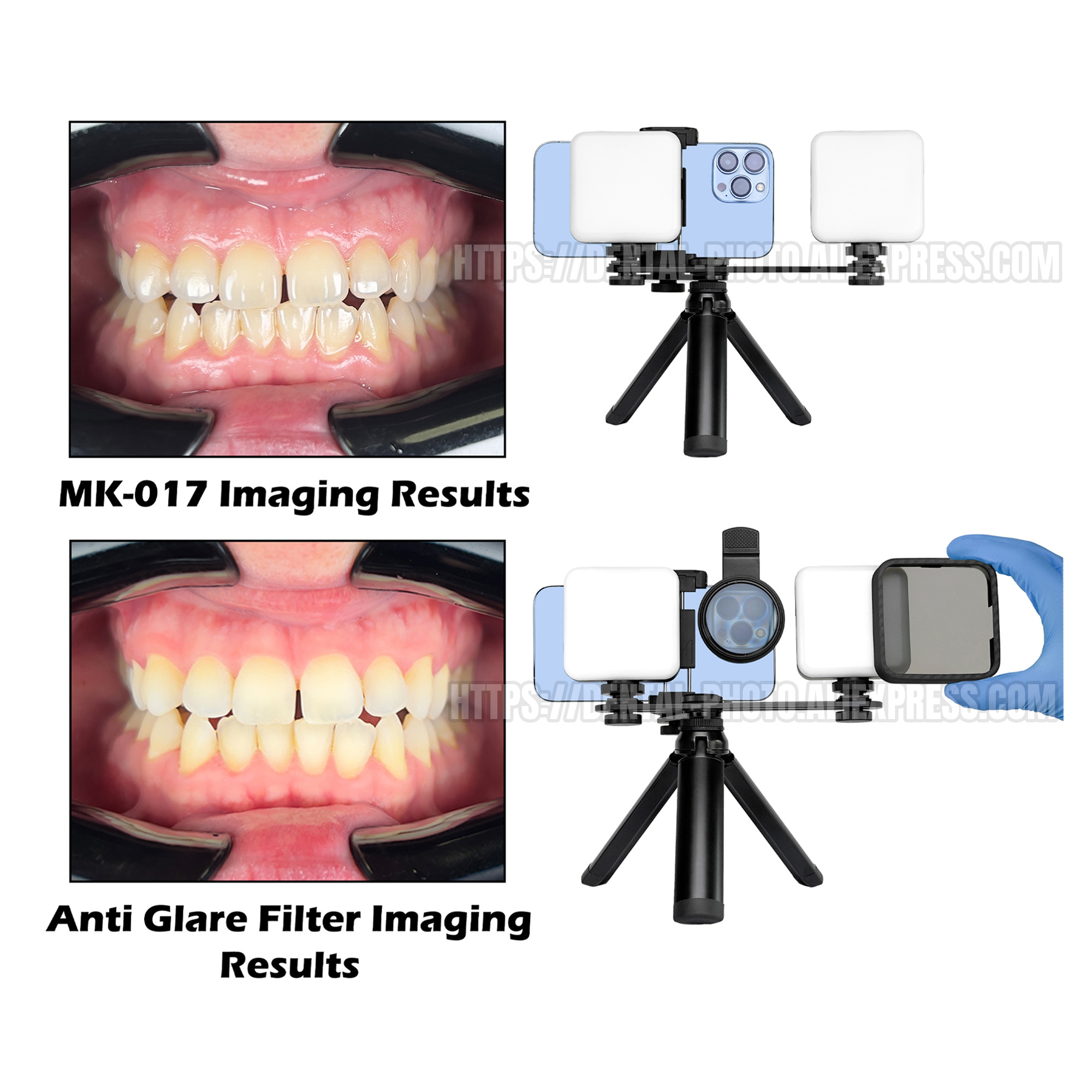 ไฟ LED เติมแสงสำหรับถ่ายภาพโทร - Photography Mobile Lighting บทวิจารณ์และราคา